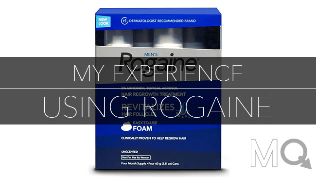 Does rogaine work? Hair loss after using minoxidil