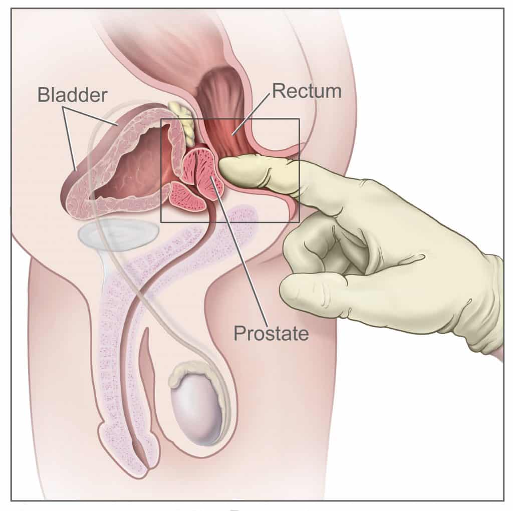 how to milk your prostate location